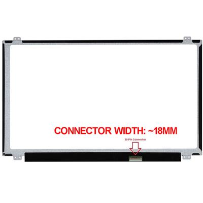 15.6" LED WXGA 1366x768 EDP 30 Pins Notebook Glossy Scherm slimline